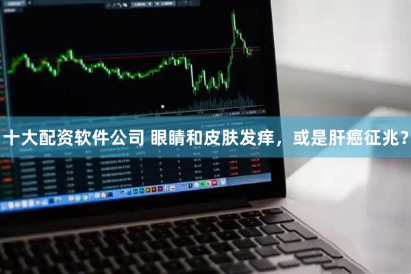 十大配资软件公司 眼睛和皮肤发痒，或是肝癌征兆？